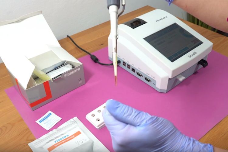 Szybki test na koronawirusa? BioStat i Śląskie Perły kupili sprzęt dla szpitala, YouTube