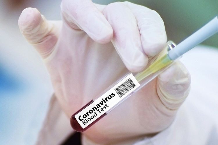 NFZ: testy na koronawirusa dla pacjentów i personelu każdego szpitala, Pixabay