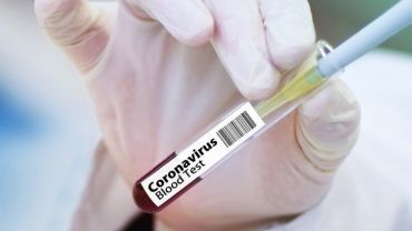 NFZ: testy na koronawirusa dla pacjentów i personelu każdego szpitala